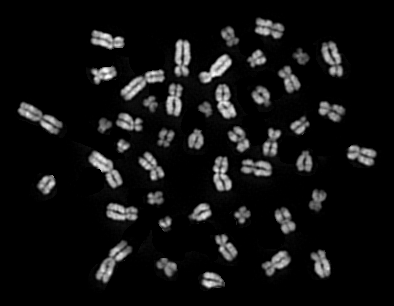 Metafase Normale 1 in bandeggio Q